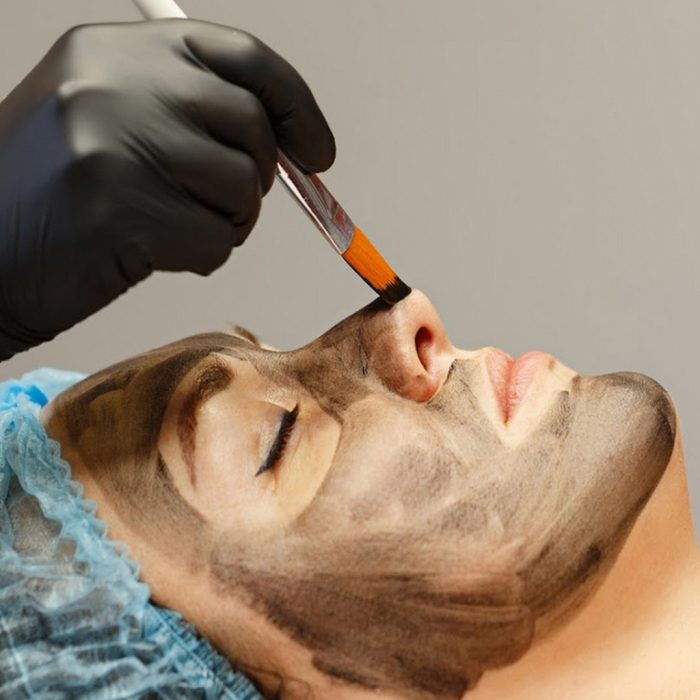 Carbon Peel - China Doll Facial